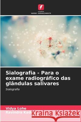 Sialografia - Para o exame radiogr?fico das gl?ndulas salivares Vidya Lohe Ravindra Kadu 9786207261581