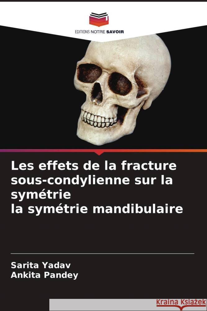 Les effets de la fracture sous-condylienne sur la sym?trie la sym?trie mandibulaire Sarita Yadav Ankita Pandey 9786207272648