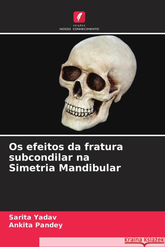 Os efeitos da fratura subcondilar na Simetria Mandibular Sarita Yadav Ankita Pandey 9786207272662 Edicoes Nosso Conhecimento