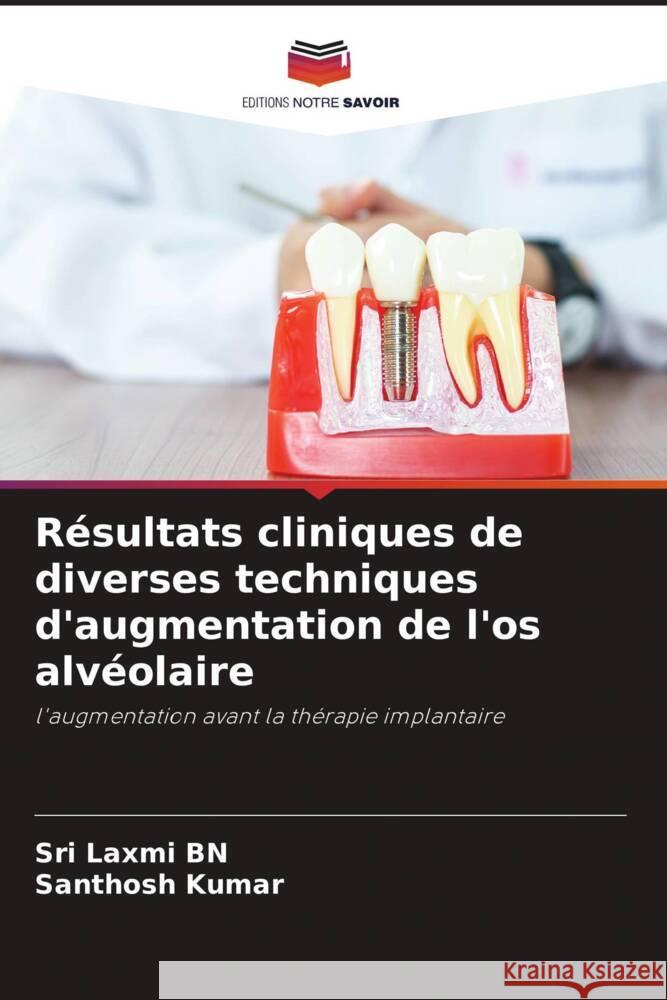 R?sultats cliniques de diverses techniques d'augmentation de l'os alv?olaire Sri Laxmi Bn Santhosh Kumar 9786207281077