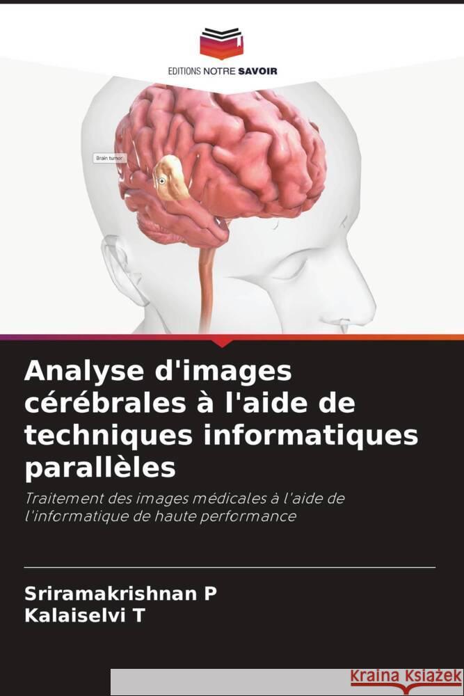 Analyse d'images c?r?brales ? l'aide de techniques informatiques parall?les Sriramakrishnan P Kalaiselvi T 9786207281138