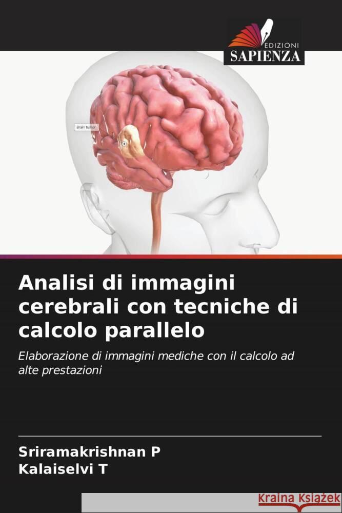 Analisi di immagini cerebrali con tecniche di calcolo parallelo Sriramakrishnan P Kalaiselvi T 9786207281145