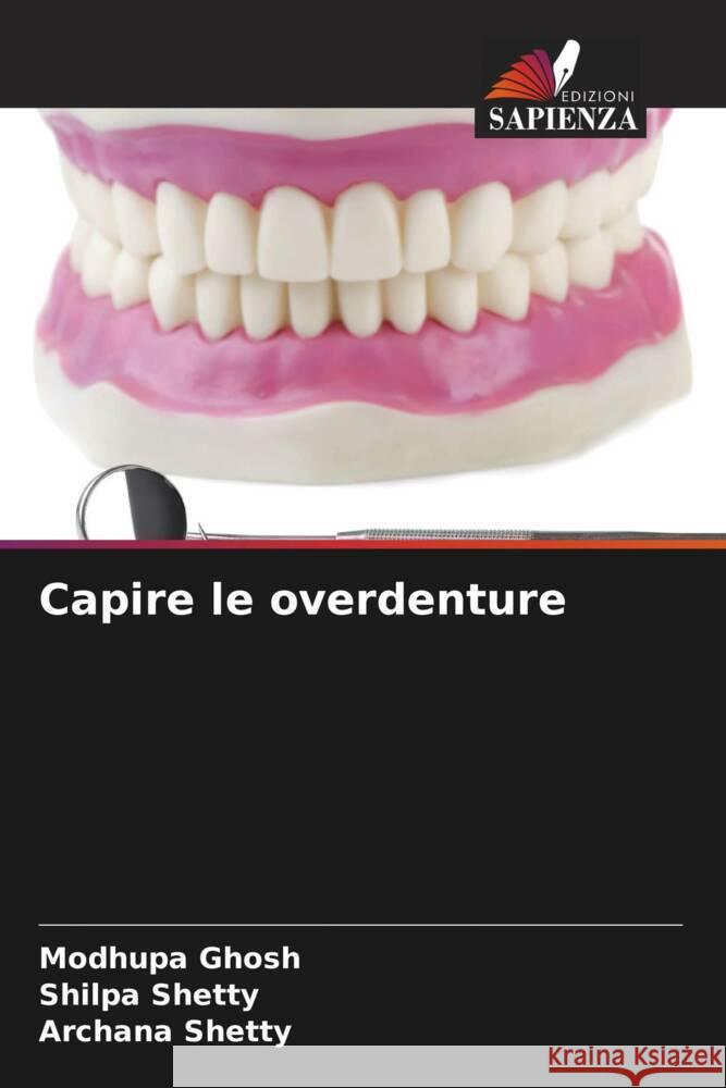 Capire le overdenture Modhupa Ghosh Shilpa Shetty Archana Shetty 9786207293230