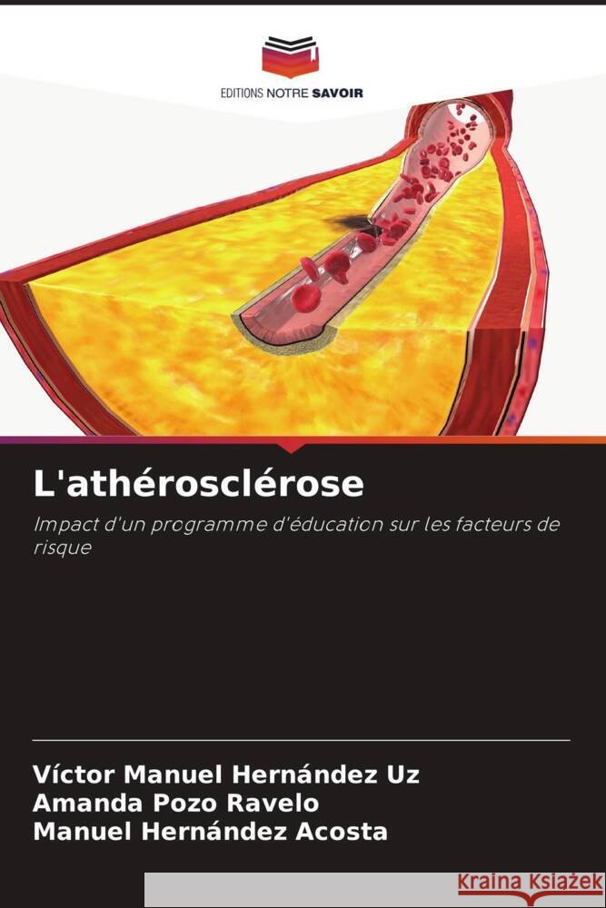 L'ath?roscl?rose V?ctor Manuel Hern?nde Amanda Poz Manuel Hern?nde 9786207302512 Editions Notre Savoir