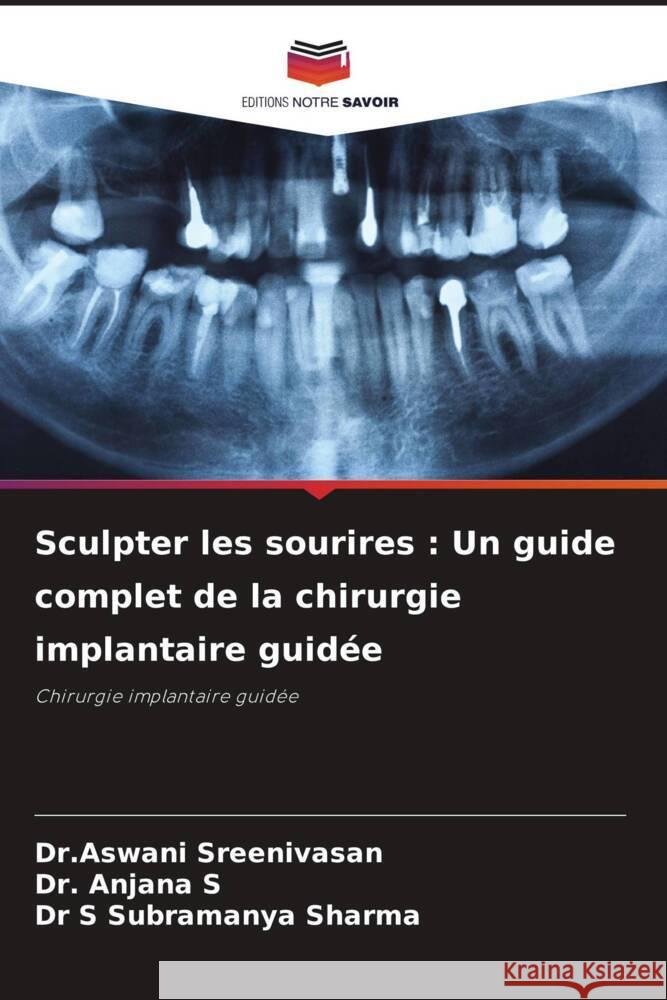 Sculpter les sourires: Un guide complet de la chirurgie implantaire guid?e Dr Aswani Sreenivasan Anjana S S. Subramanya Sharma 9786207308897 Editions Notre Savoir