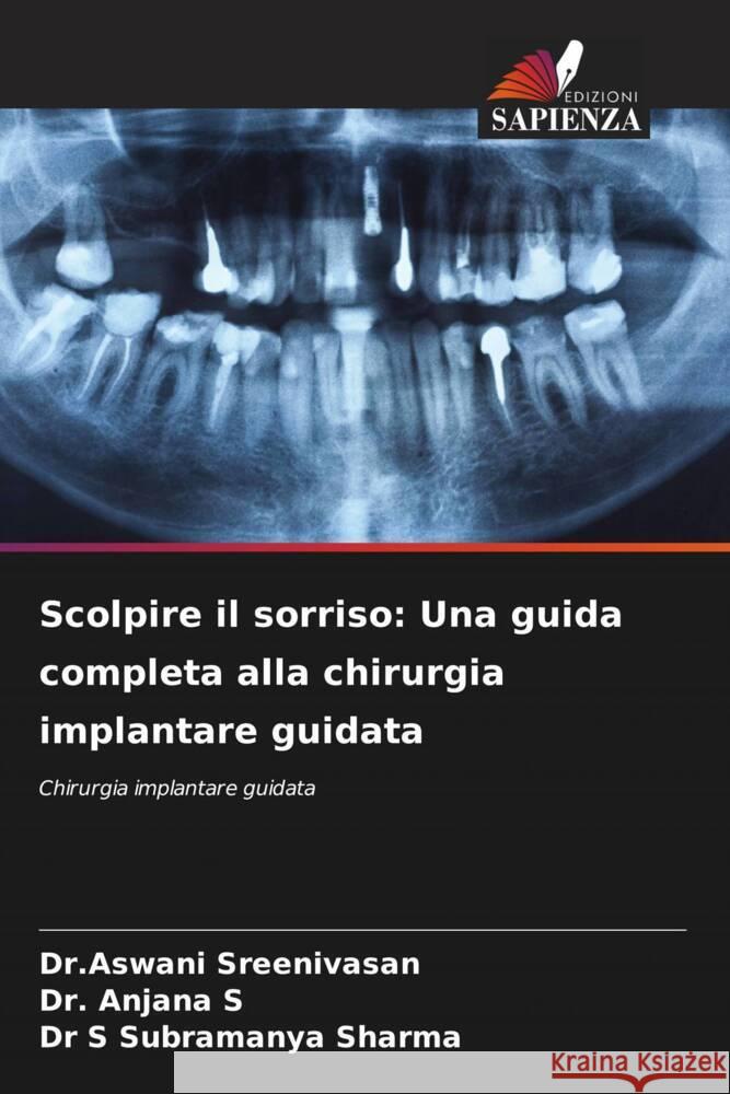 Scolpire il sorriso: Una guida completa alla chirurgia implantare guidata Dr Aswani Sreenivasan Anjana S S. Subramanya Sharma 9786207308903 Edizioni Sapienza