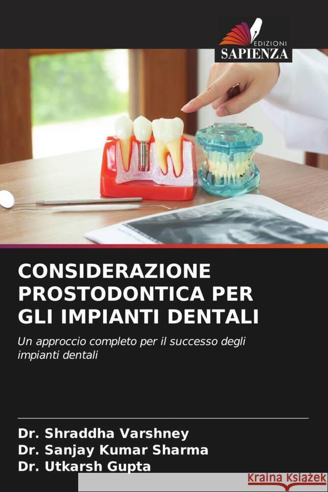 Considerazione Prostodontica Per Gli Impianti Dentali Shraddha Varshney Sanjay Kumar Sharma Utkarsh Gupta 9786207311187