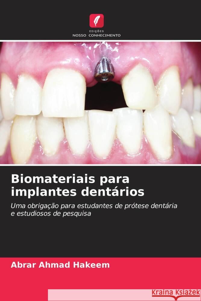 Biomateriais para implantes dent?rios Abrar Ahmad Hakeem 9786207313846 Edicoes Nosso Conhecimento