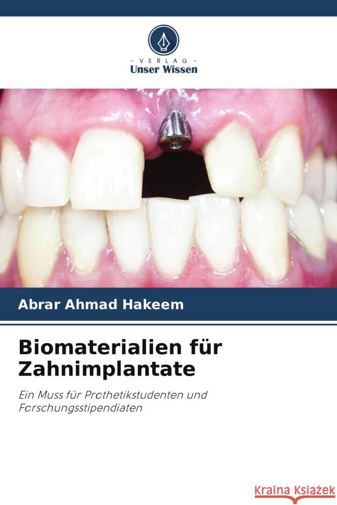 Biomaterialien f?r Zahnimplantate Abrar Ahmad Hakeem 9786207313853