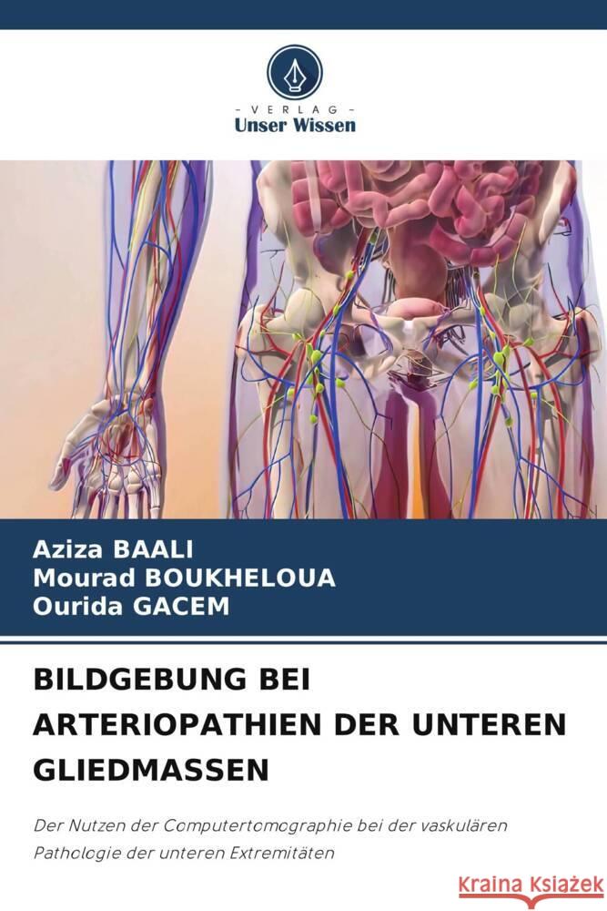 Bildgebung Bei Arteriopathien Der Unteren Gliedmassen Aziza Baali Mourad Boukheloua Ourida Gacem 9786207322473 Verlag Unser Wissen