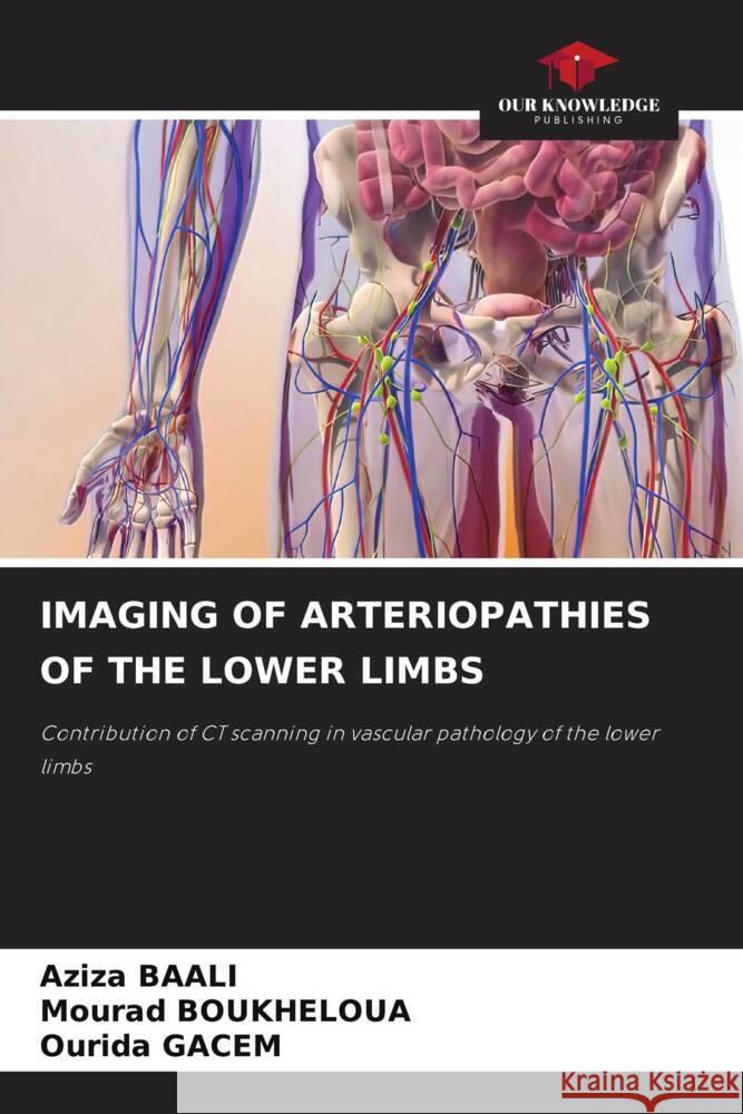 Imaging of Arteriopathies of the Lower Limbs Aziza Baali Mourad Boukheloua Ourida Gacem 9786207322664 Our Knowledge Publishing