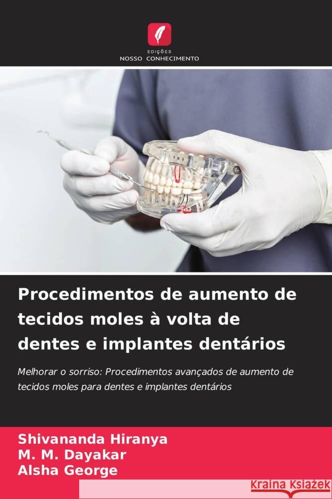 Procedimentos de aumento de tecidos moles ? volta de dentes e implantes dent?rios Shivananda Hiranya M. M. Dayakar Alsha George 9786207325061 Edicoes Nosso Conhecimento