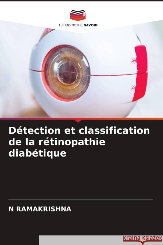 D?tection et classification de la r?tinopathie diab?tique N. Ramakrishna 9786207337040