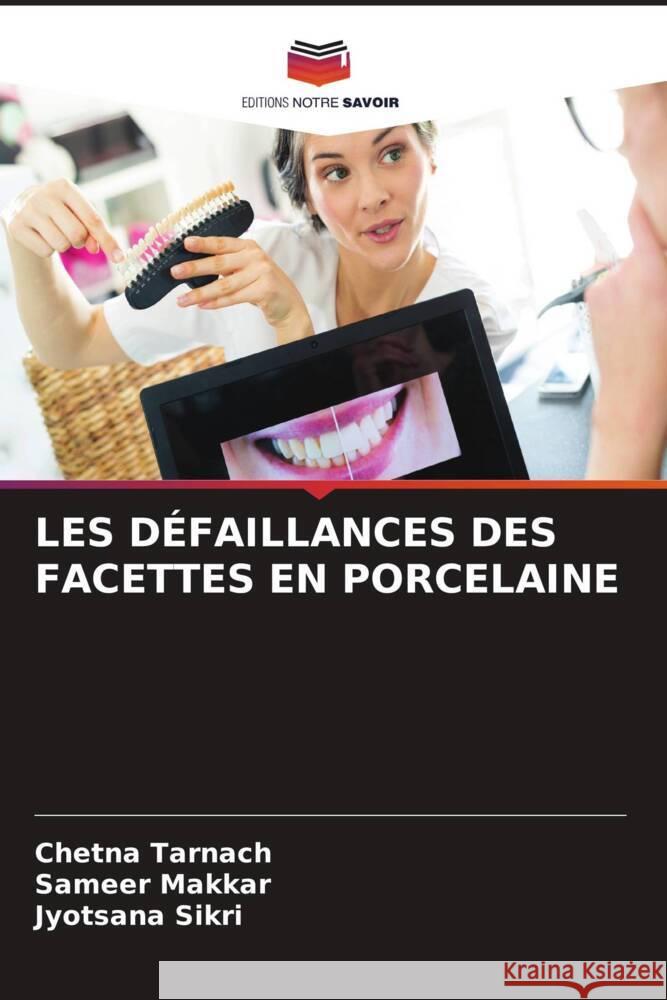 Les D?faillances Des Facettes En Porcelaine Chetna Tarnach Sameer Makkar Jyotsana Sikri 9786207339730