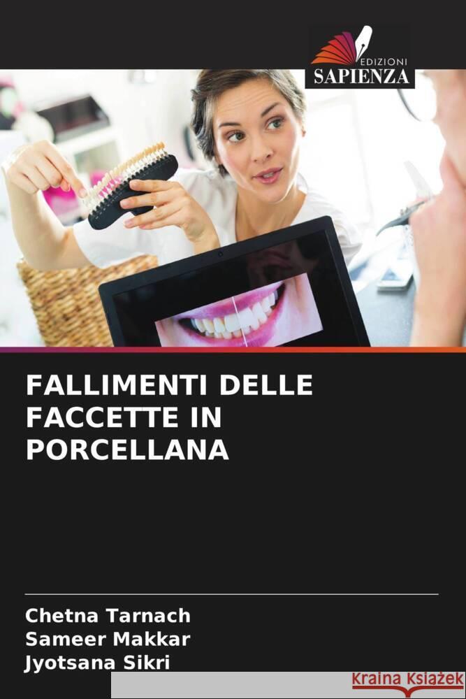 Fallimenti Delle Faccette in Porcellana Chetna Tarnach Sameer Makkar Jyotsana Sikri 9786207339815