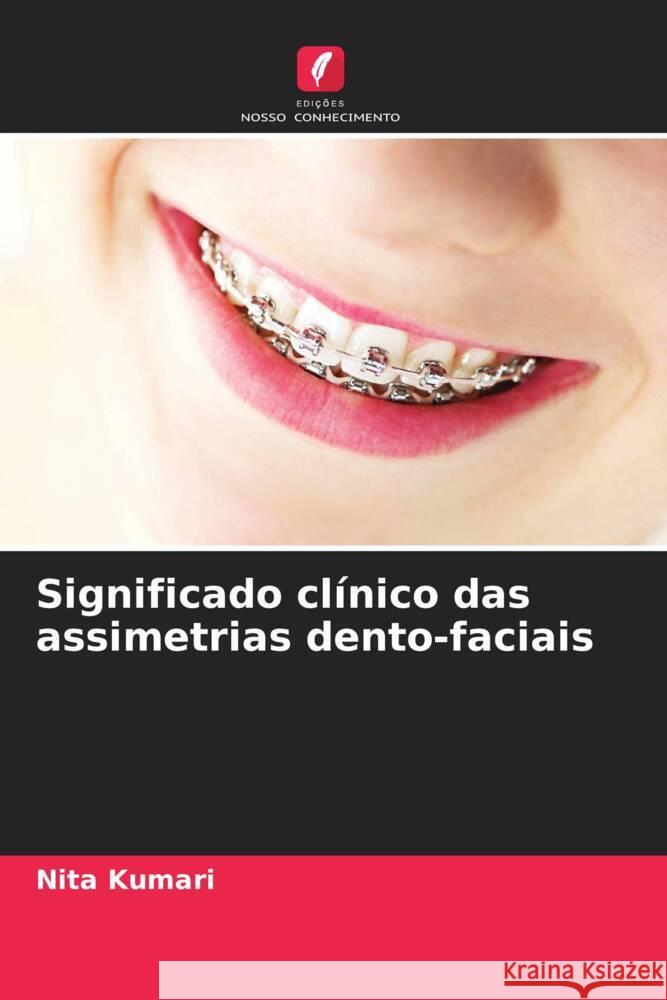 Significado cl?nico das assimetrias dento-faciais Nita Kumari 9786207339822 Edicoes Nosso Conhecimento