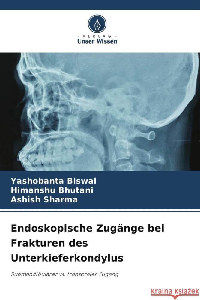 Endoskopische Zug?nge bei Frakturen des Unterkieferkondylus Yashobanta Biswal Himanshu Bhutani Ashish Sharma 9786207351480