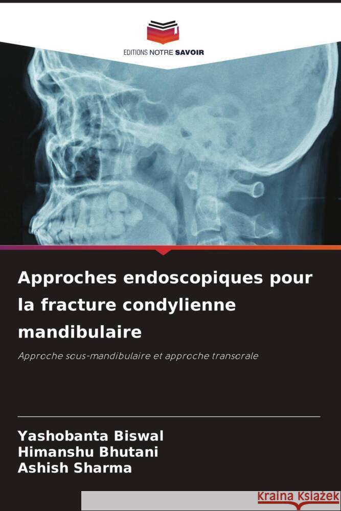 Approches endoscopiques pour la fracture condylienne mandibulaire Yashobanta Biswal Himanshu Bhutani Ashish Sharma 9786207351503