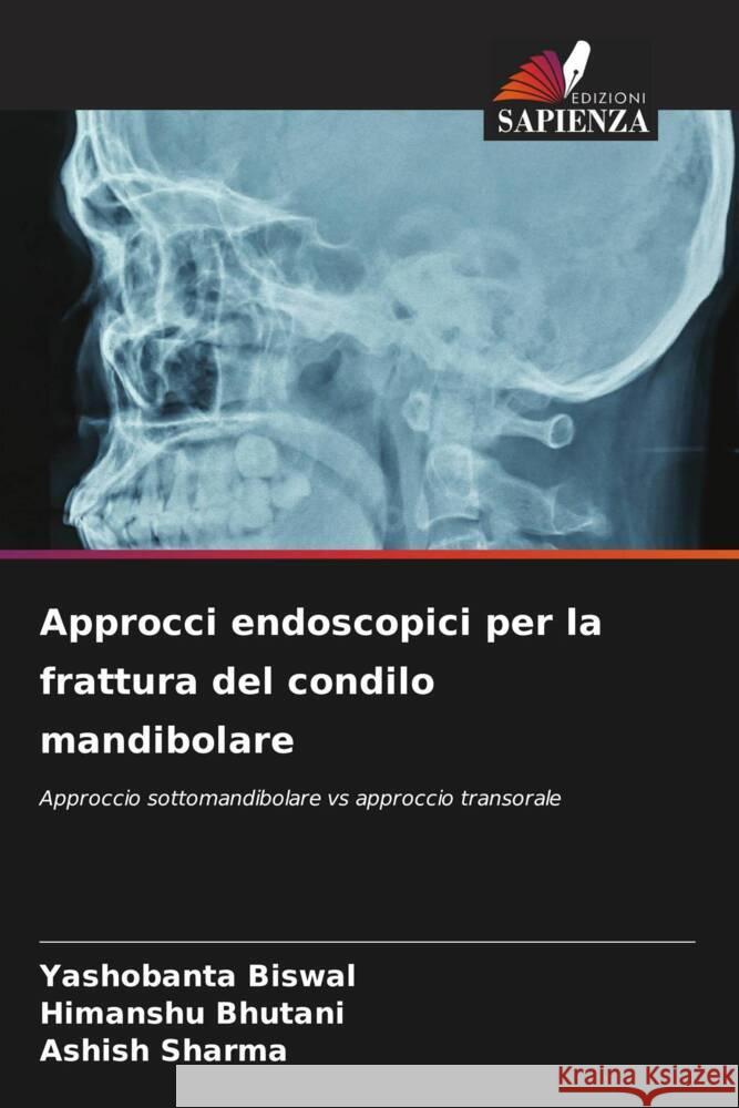 Approcci endoscopici per la frattura del condilo mandibolare Yashobanta Biswal Himanshu Bhutani Ashish Sharma 9786207351510