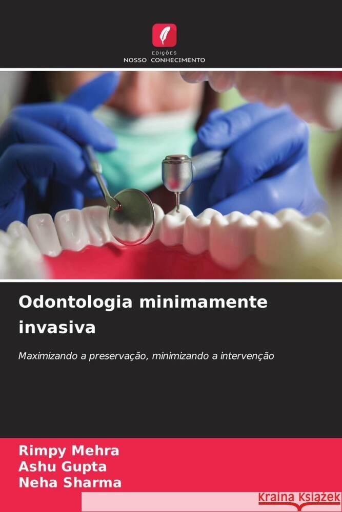 Odontologia minimamente invasiva Rimpy Mehra Ashu Gupta Neha Sharma 9786207352029 Edicoes Nosso Conhecimento