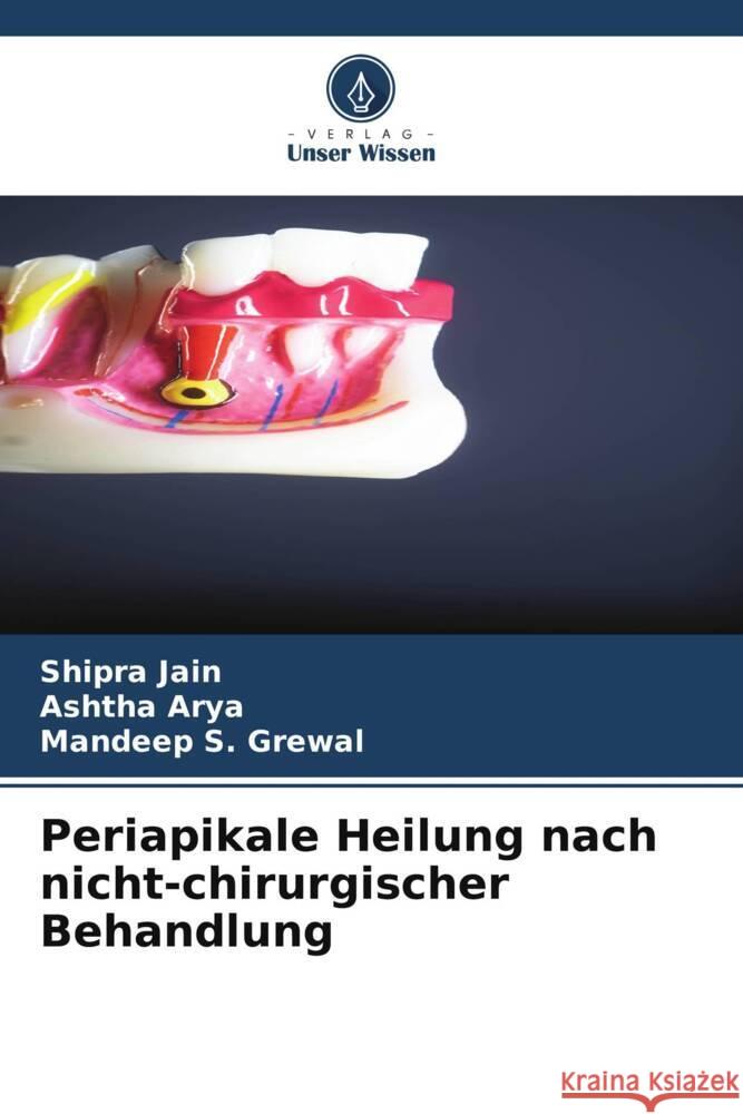 Periapikale Heilung nach nicht-chirurgischer Behandlung Shipra Jain Ashtha Arya Mandeep S. Grewal 9786207356300