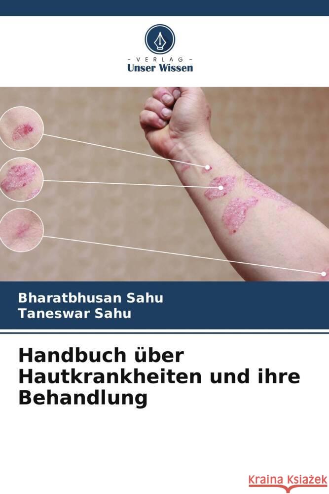 Handbuch ?ber Hautkrankheiten und ihre Behandlung Bharatbhusan Sahu Taneswar Sahu 9786207372430