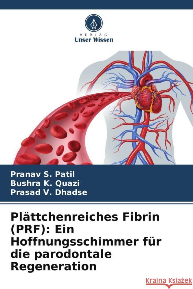 Pl?ttchenreiches Fibrin (PRF): Ein Hoffnungsschimmer f?r die parodontale Regeneration Pranav S. Patil Bushra K Prasad V. Dhadse 9786207373277