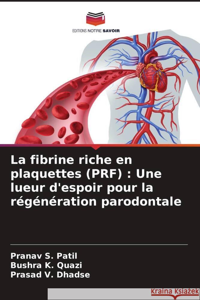 La fibrine riche en plaquettes (PRF): Une lueur d'espoir pour la r?g?n?ration parodontale Pranav S. Patil Bushra K Prasad V. Dhadse 9786207373284