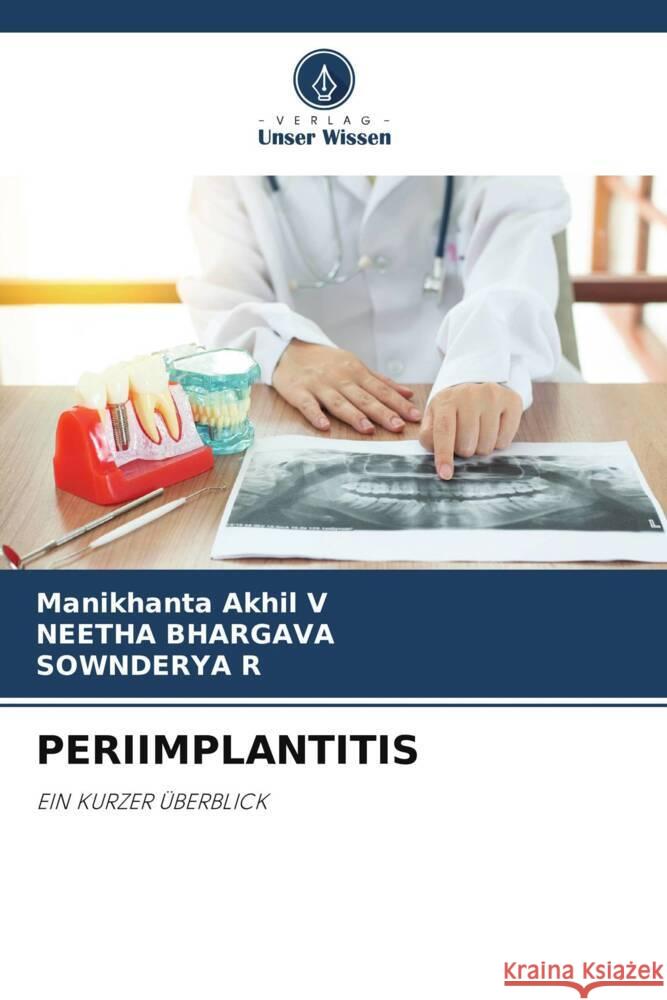 Periimplantitis Manikhanta Akhi Neetha Bhargava Sownderya R 9786207382903