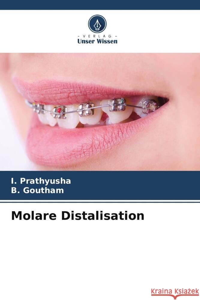 Molare Distalisation I. Prathyusha B. Goutham 9786207387823 Verlag Unser Wissen