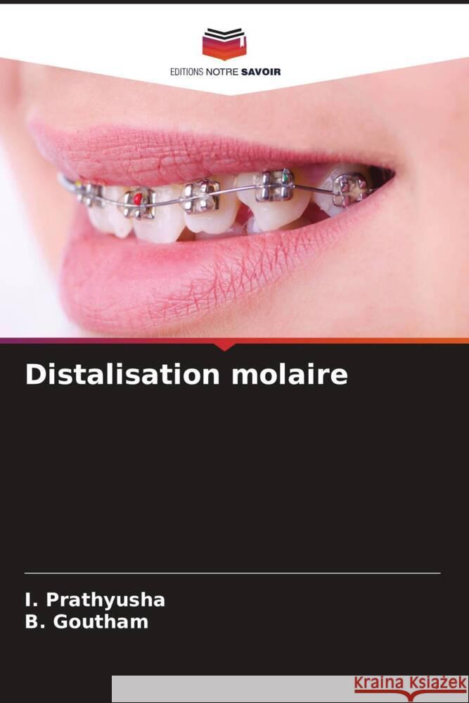 Distalisation molaire I. Prathyusha B. Goutham 9786207387847 Editions Notre Savoir