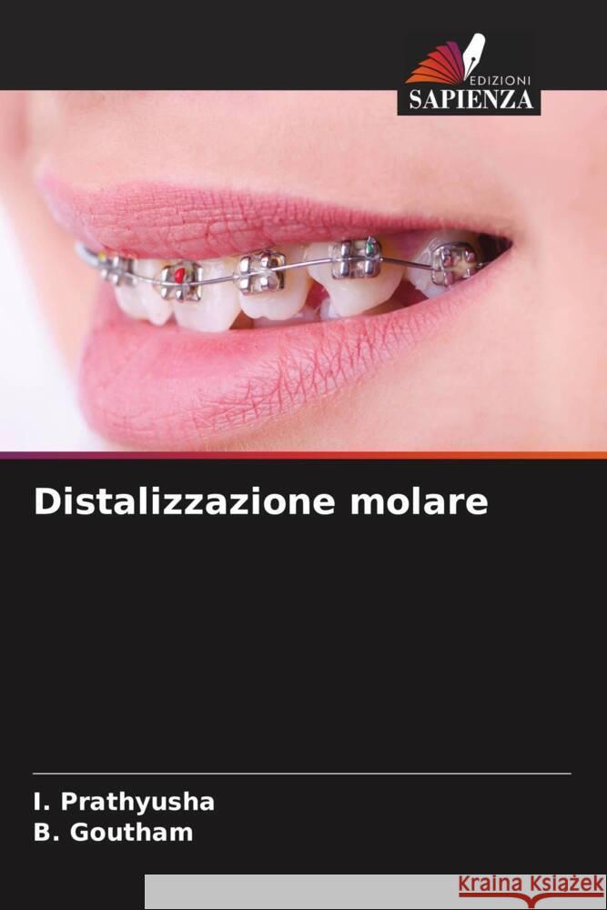 Distalizzazione molare I. Prathyusha B. Goutham 9786207387854 Edizioni Sapienza