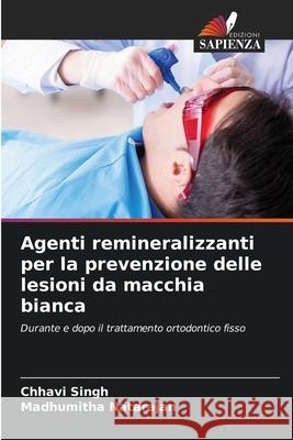 Agenti remineralizzanti per la prevenzione delle lesioni da macchia bianca Chhavi Singh Madhumitha Natarajan 9786207388967