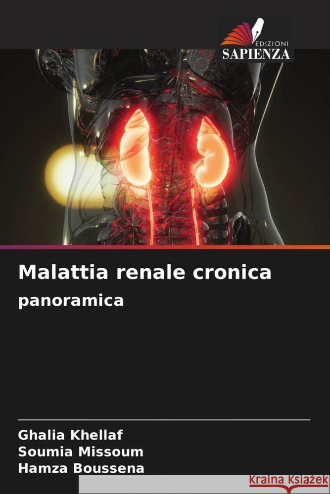 Malattia renale cronica panoramica Ghalia Khellaf Soumia Missoum Hamza Boussena 9786207390540