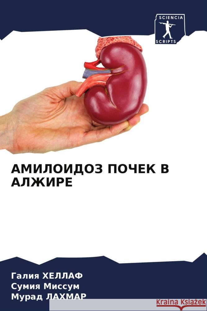 АМИЛОИДОЗ ПОЧЕК В АЛЖИРЕ ХЕЛЛАj Миссуl ЛАХМА 9786207390625 Sciencia Scripts