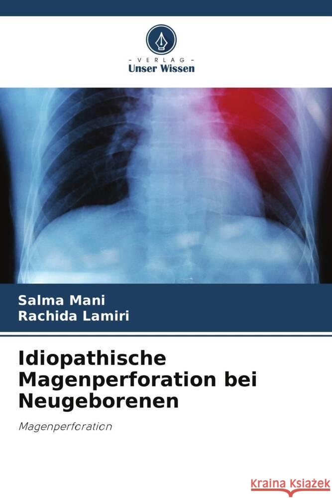 Idiopathische Magenperforation bei Neugeborenen Salma Mani Rachida Lamiri 9786207402717