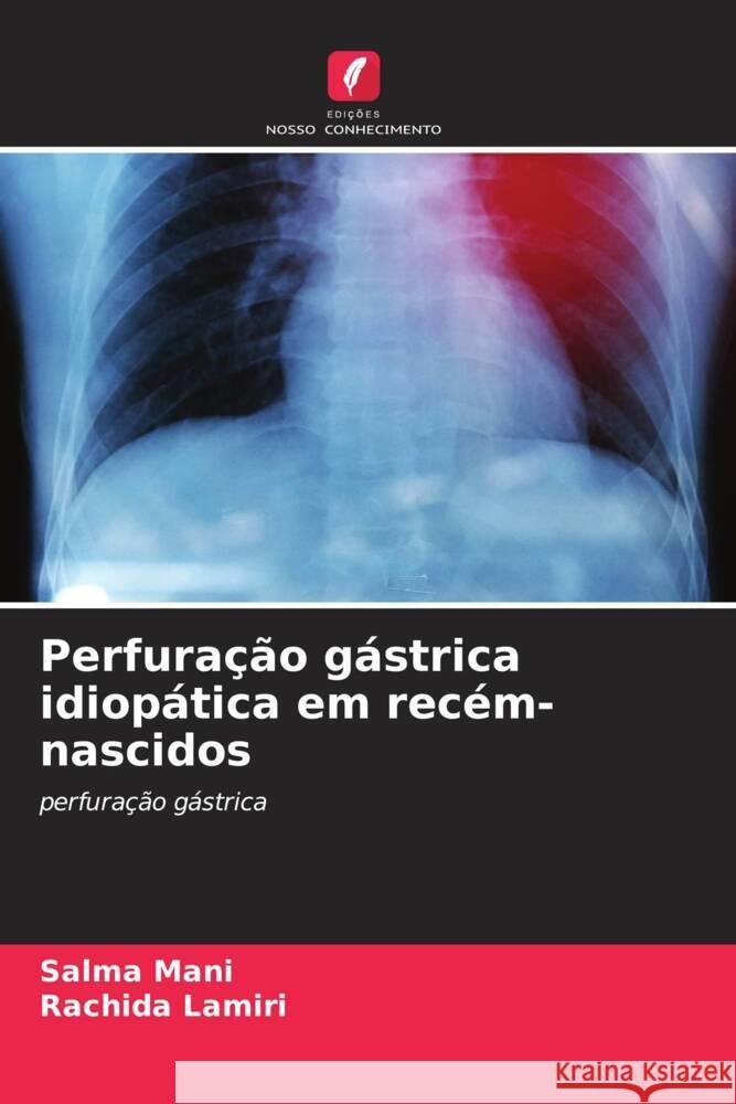 Perfura??o g?strica idiop?tica em rec?m-nascidos Salma Mani Rachida Lamiri 9786207402779
