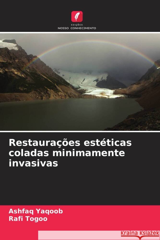 Restaura??es est?ticas coladas minimamente invasivas Ashfaq Yaqoob Rafi Togoo 9786207406418