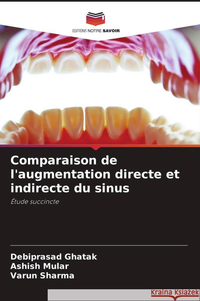 Comparaison de l'augmentation directe et indirecte du sinus Debiprasad Ghatak Ashish Mular Varun Sharma 9786207408979 Editions Notre Savoir