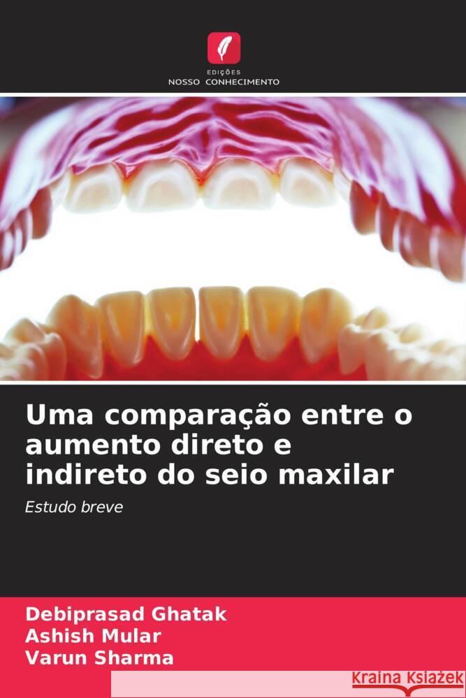 Uma compara??o entre o aumento direto e indireto do seio maxilar Debiprasad Ghatak Ashish Mular Varun Sharma 9786207408993 Edicoes Nosso Conhecimento