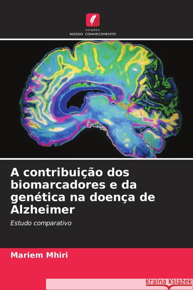 A contribui??o dos biomarcadores e da gen?tica na doen?a de Alzheimer Mariem Mhiri 9786207409297 Edicoes Nosso Conhecimento