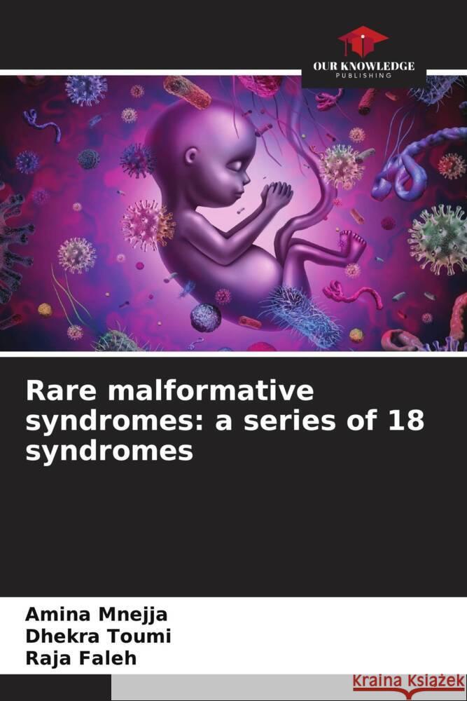 Rare malformative syndromes: a series of 18 syndromes Amina Mnejja Dhekra Toumi Raja Faleh 9786207429684