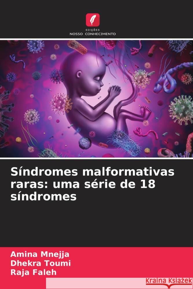 S?ndromes malformativas raras: uma s?rie de 18 s?ndromes Amina Mnejja Dhekra Toumi Raja Faleh 9786207429714