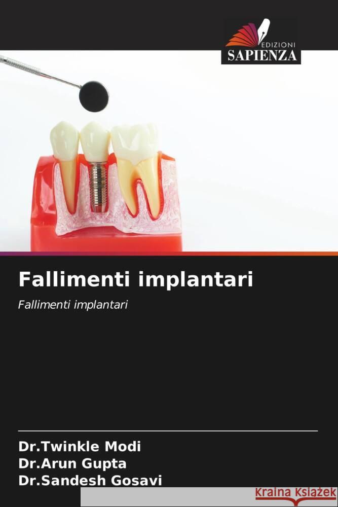 Fallimenti implantari Dr Twinkle Modi Dr Arun Gupta Dr Sandesh Gosavi 9786207430611
