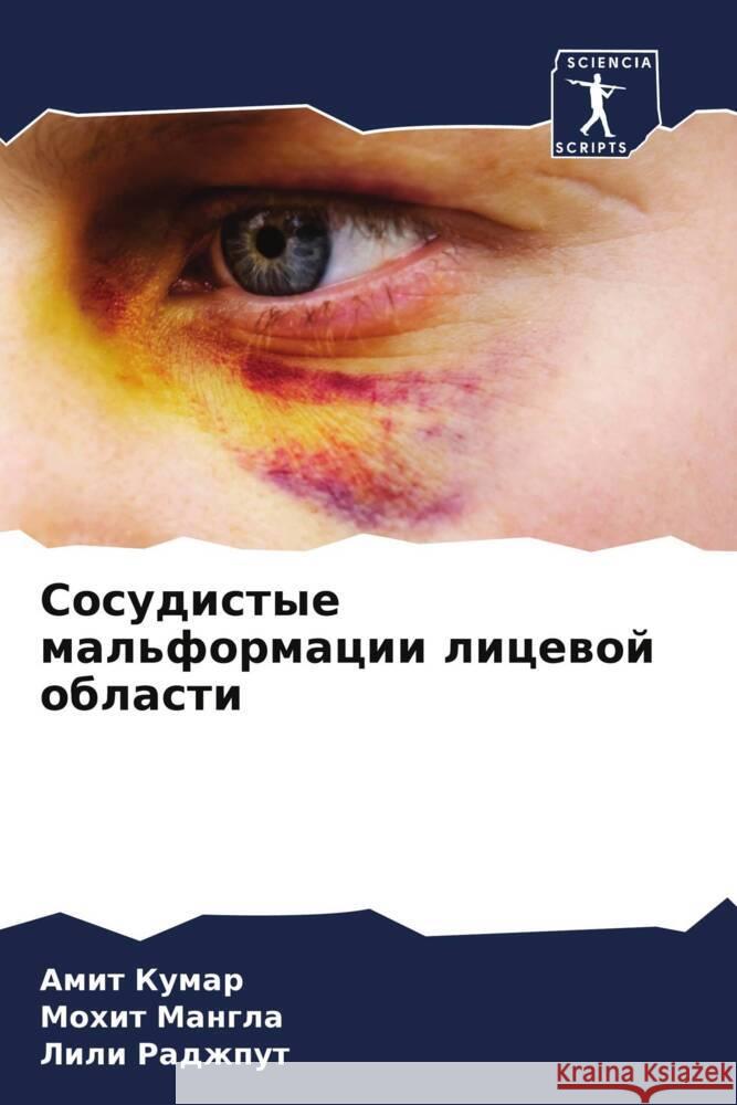 Сосудистые мальформаци&#  Кумар Манглk Раджп
 9786207434558 Sciencia Scripts