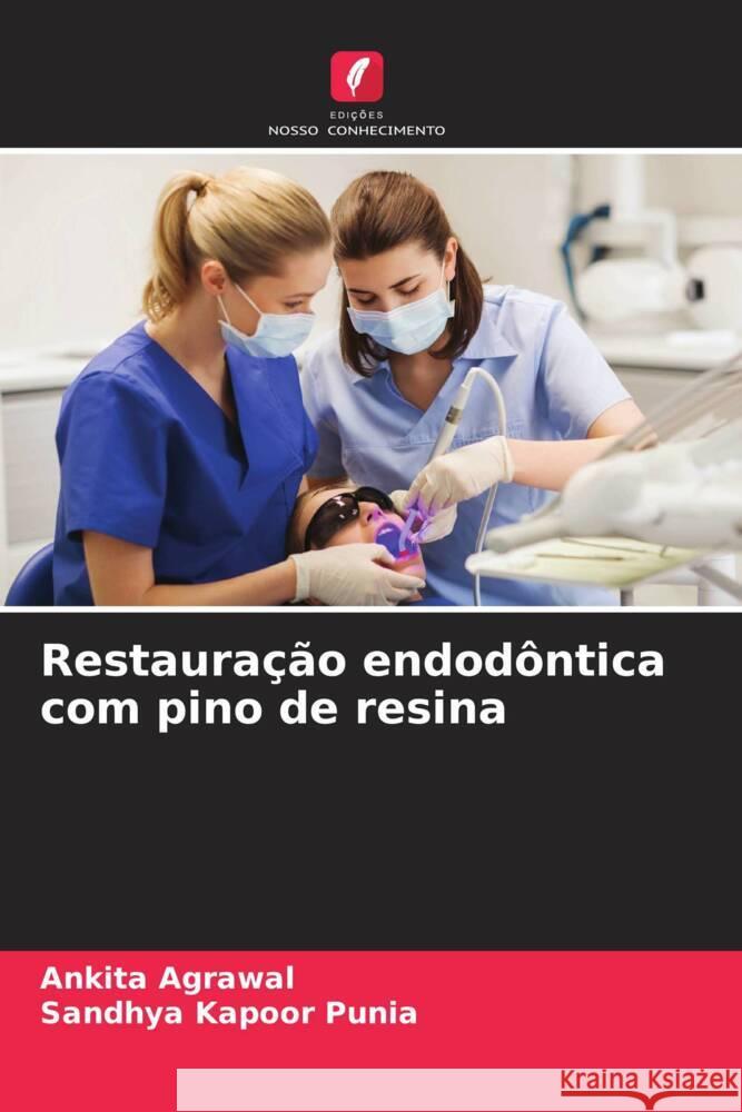 Restaura??o endod?ntica com pino de resina Ankita Agrawal Sandhya Kapoo 9786207437610 Edicoes Nosso Conhecimento