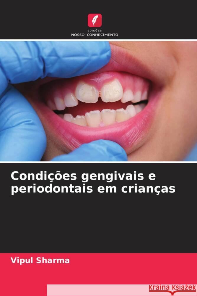 Condi??es gengivais e periodontais em crian?as Vipul Sharma 9786207437979 Edicoes Nosso Conhecimento