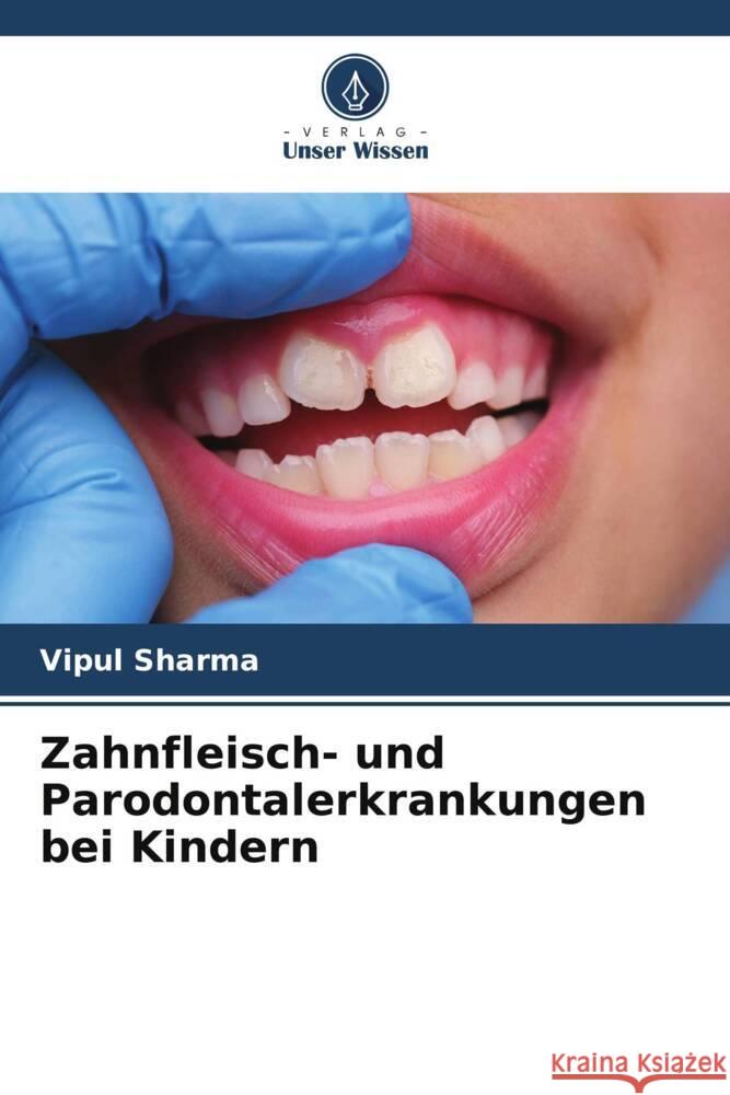 Zahnfleisch- und Parodontalerkrankungen bei Kindern Vipul Sharma 9786207438044 Verlag Unser Wissen