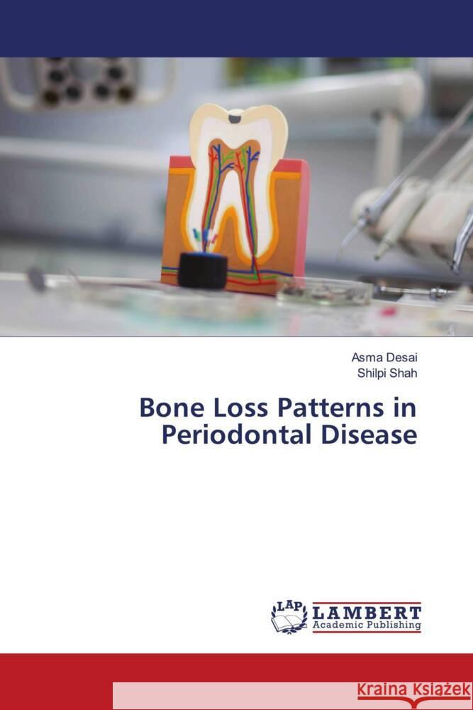 Bone Loss Patterns in Periodontal Disease Desai, Asma, Shah, Shilpi 9786207448289