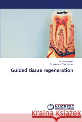 Guided tissue regeneration Anish, Dr. Maria, James, Dr. Johnson Raja 9786207448333